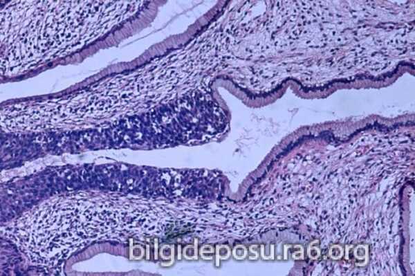 Hpv virüsünden kurtulanlar olduğu için içinizi rahat tutmalısınız.