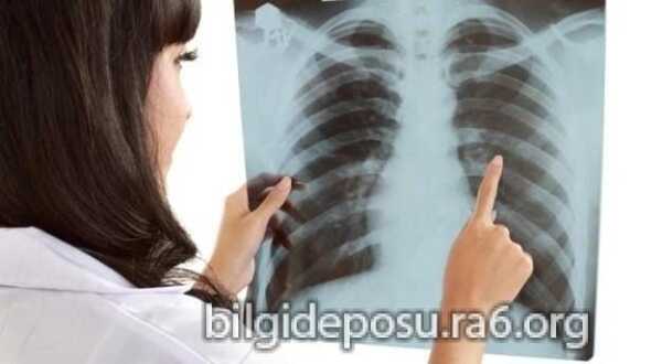 akciger kanseri nasil olusur