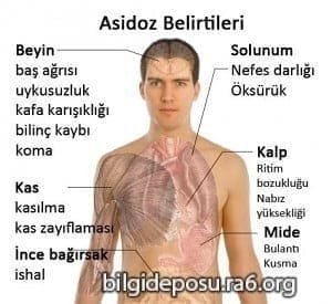 asidoz