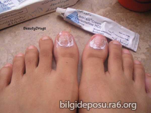 en iyi tirnak mantari ilaci scaled - Bilgideposu